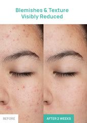 BRINGGREEN Tea Tree Cica Soothing Toner Pad